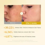 Kojic Acid Turmeric Resurfacing Toner 250ml - Image 3